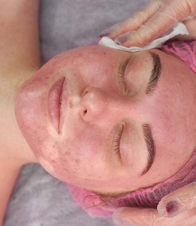 Young woman getting a facial