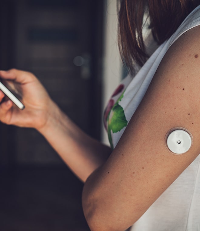Young woman wearing a CGM on her arm