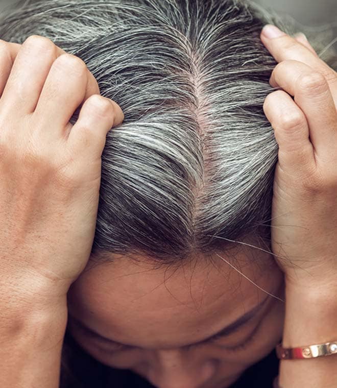 Woman with graying hair showing her balding spot