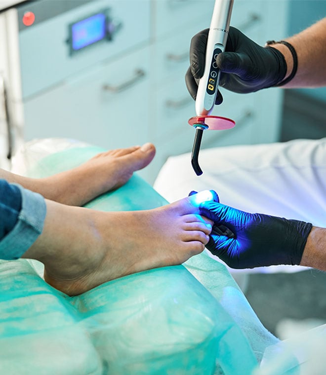 White person getting laser treatment on big toe