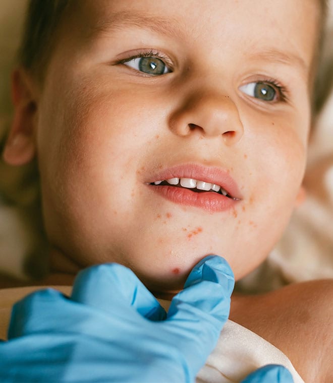 Doctor examining young boy with sores on mouth and chin
