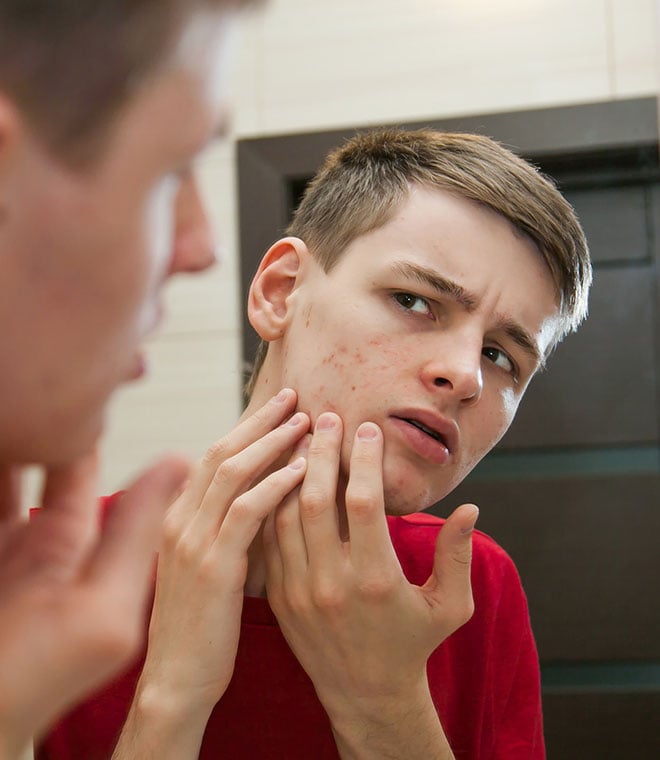 White teenager picking at acne in the mirror