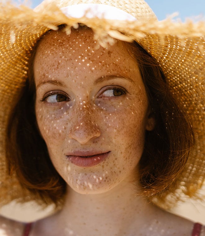Young white woman with freckles and a sun hat
