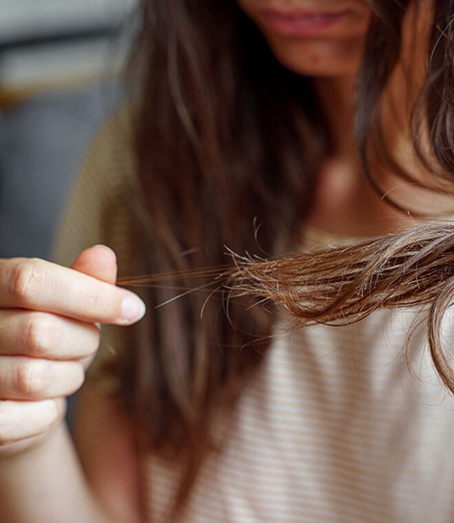 What causes female hair loss on the frontal hairline?