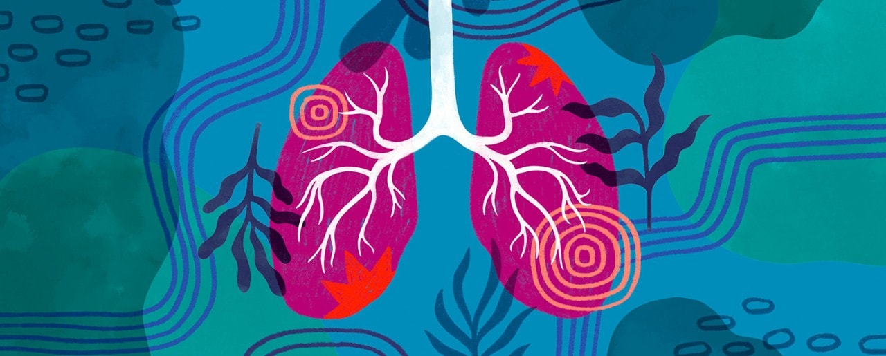 Illustration of lungs