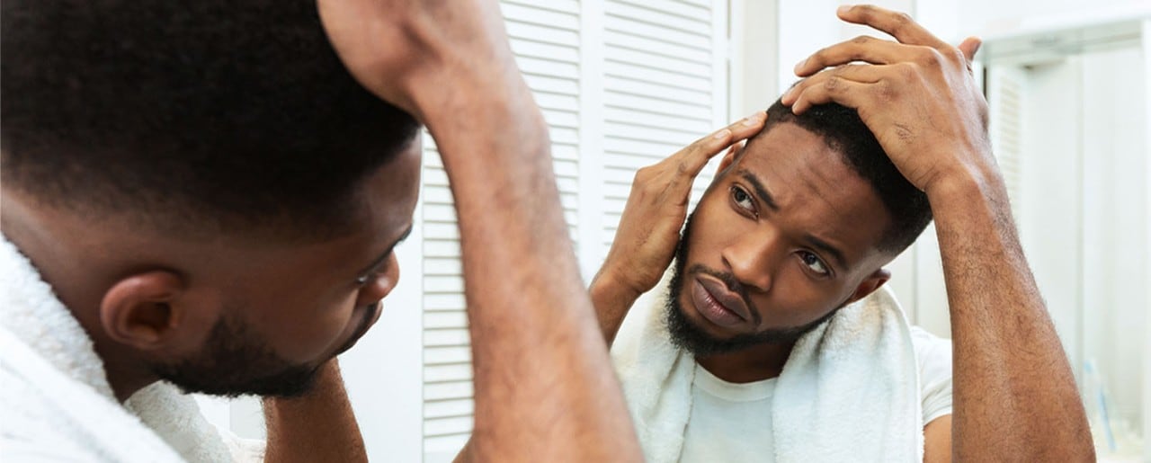 Young black man checking his hair for thinning spots